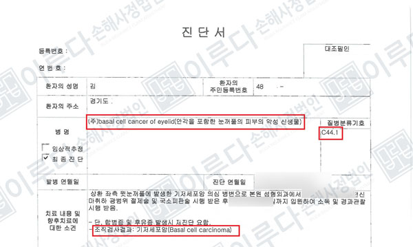 [C44] 기저세포암종 손해사정사례 이루다 성공사례 썸네일